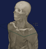 Vesalii
